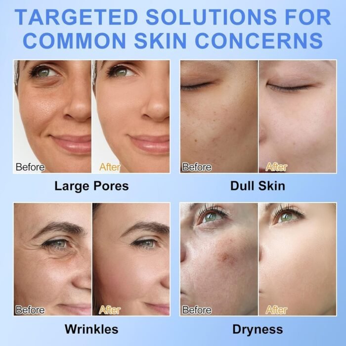 713TtrRhRRL._AC_SL1500.jpg 713TtrRhRRL._AC_SL1500.jpg