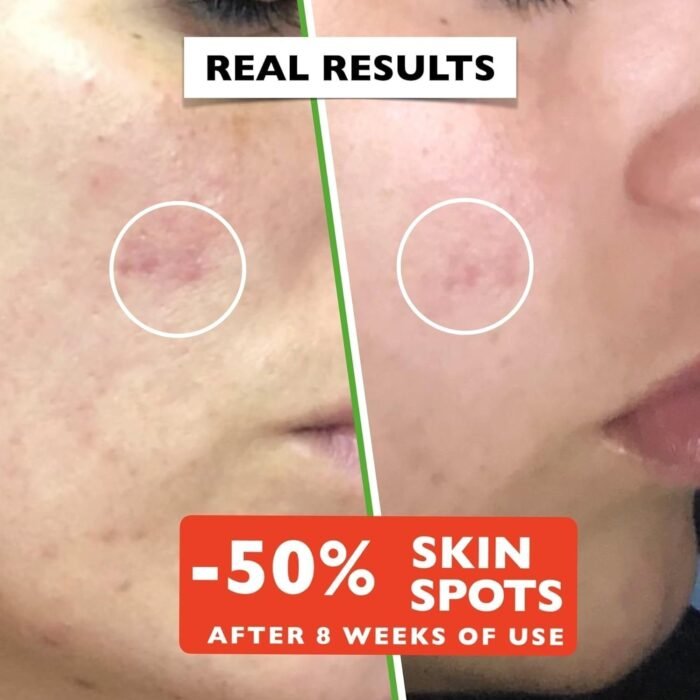 71Mue4BugL._AC_SL1500.jpg 71Mue4BugL._AC_SL1500.jpg