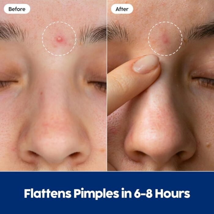 81TW6vNmQHL._AC_SL1500.jpg 81TW6vNmQHL._AC_SL1500.jpg